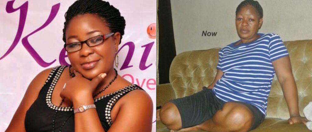 Nollywood Actress Omotunde Ogundimu Appeals for Help Amid Cervical Cancer Battle